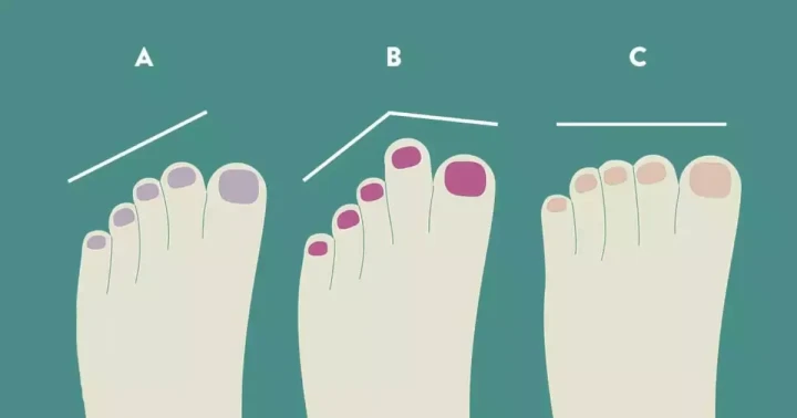 اعرف شخصيتك من شكل أصابع قدميك